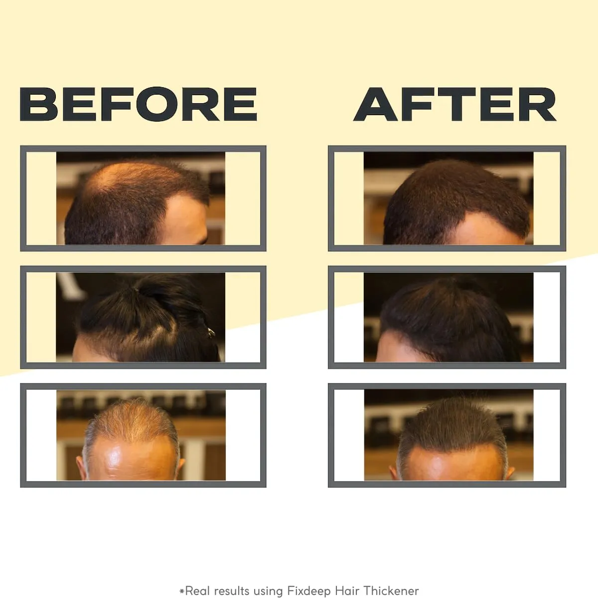 Hair Fibers for Thinning Hair | Waterproof & Sweat-Resistant - Instantly Fuller Hair in 30 Seconds - 14g - Covers Bald Spots & Gray Roots (Black)