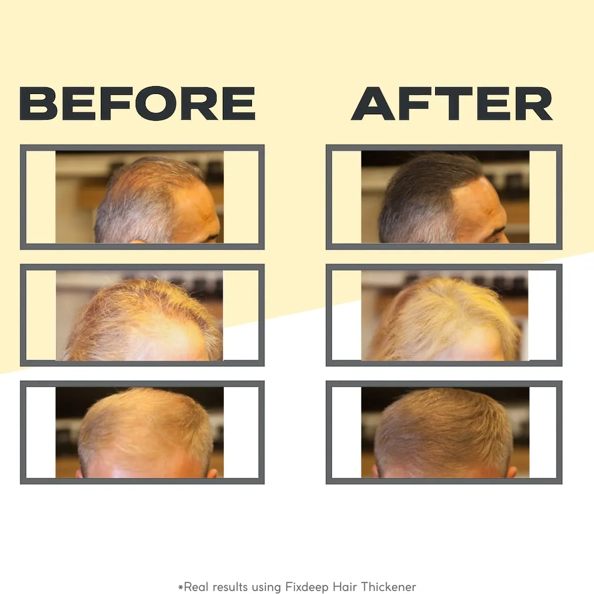Hair Fibers for Thinning Hair | Waterproof & Sweat-Resistant - Instantly Fuller Hair in 30 Seconds - 14g - Covers Bald Spots & Gray Roots (Black)